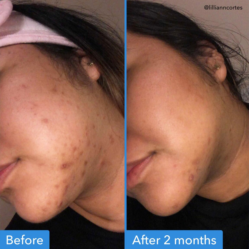 Good Molecules Discoloration Correcting Serum 30 ml alternative view 3.