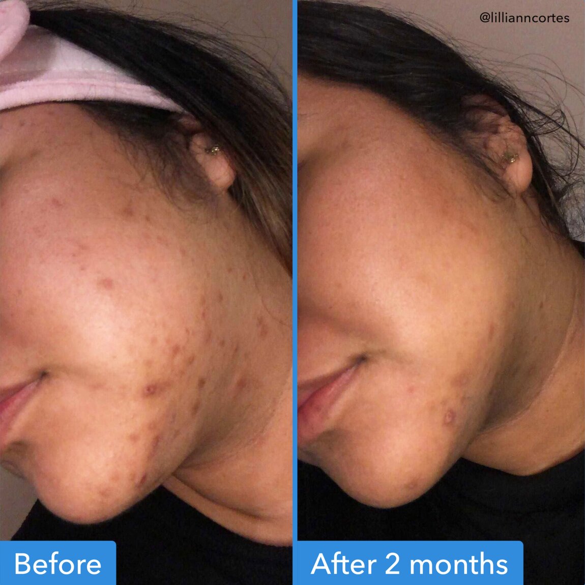 Good Molecules Discoloration Correcting Serum 30 ml alternative view 3.