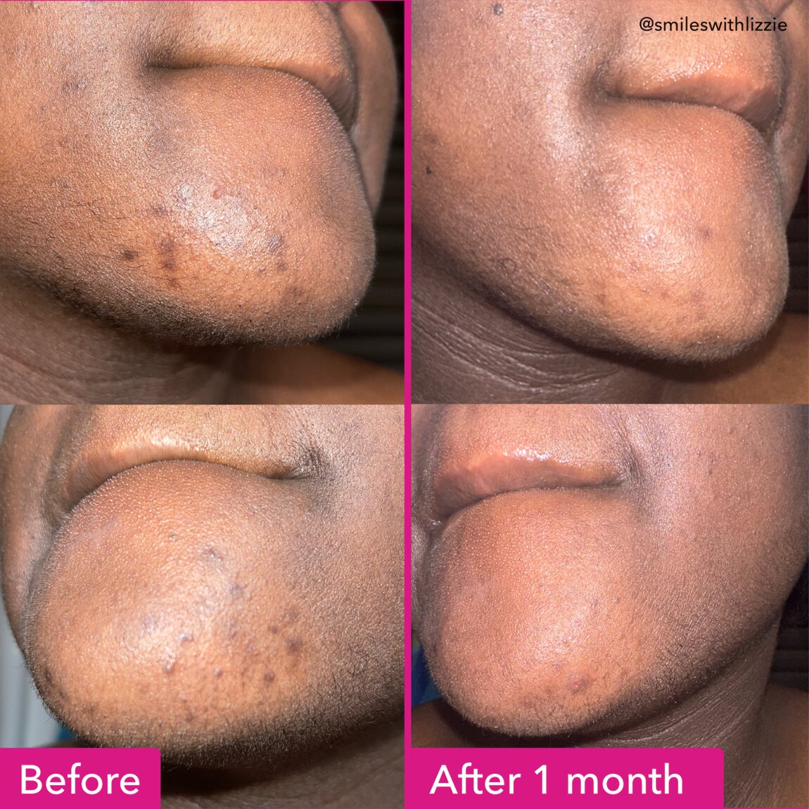 Good Molecules Brightening & Dark Spots Bar 1 Bar alternative view 3.